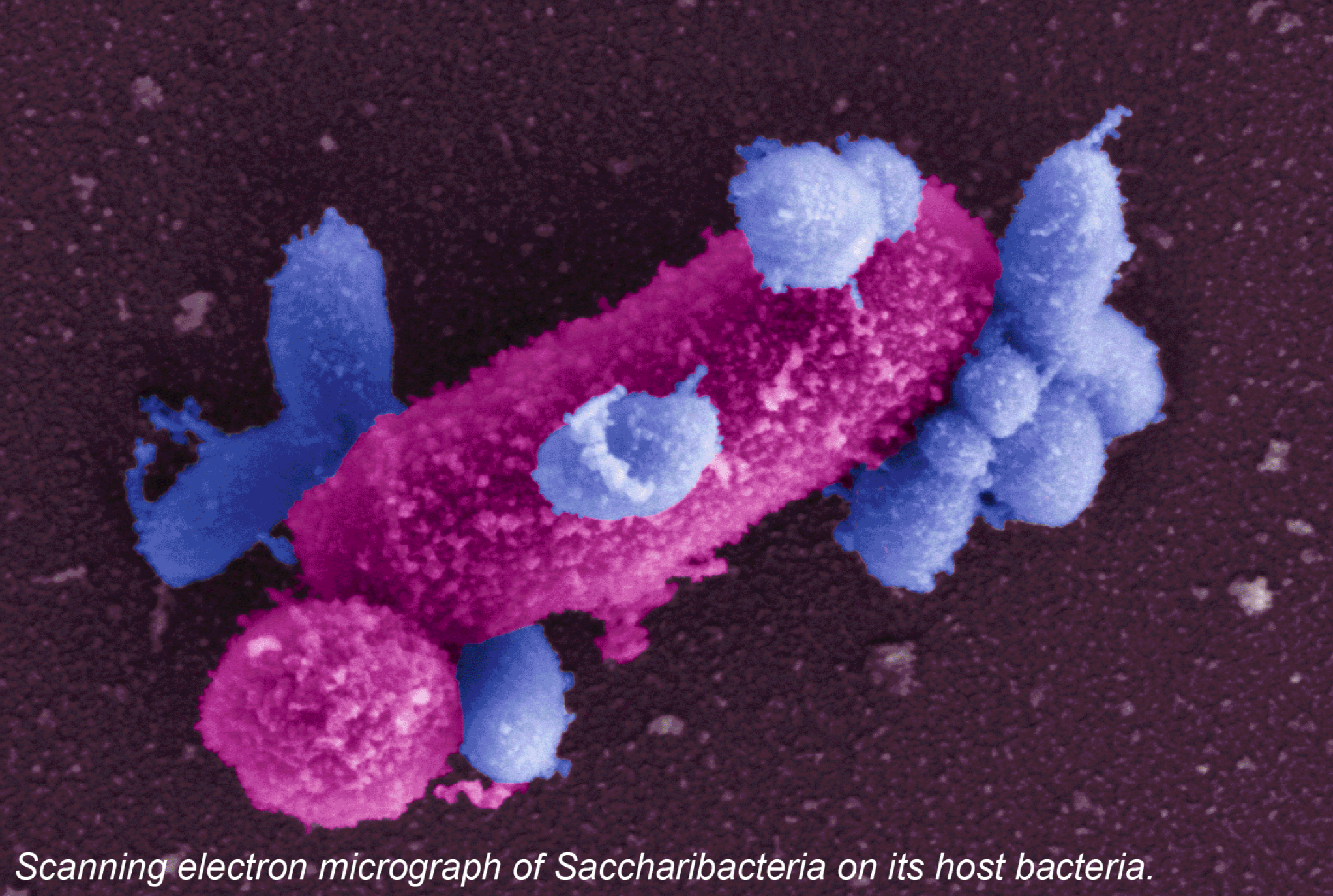 Bacteria TM7